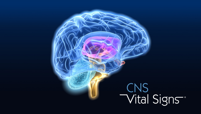 CNS vital signs . 뇌 일러스트 이미지