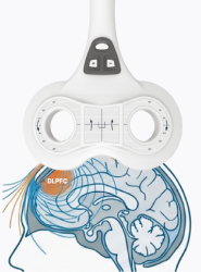 3세대 Angulated Figure-8 Coil