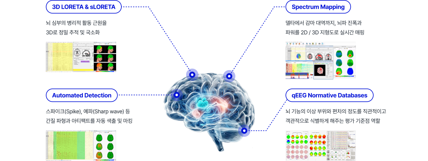 &nbsp;Neuron-Spectrum.NET 그래픽